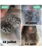 Onguent anti-crevasses / gale de boue EKIN